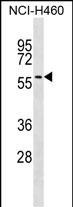 UGT2A3 Antibody in Western Blot (WB)