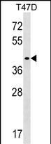 MMADHC Antibody in Western Blot (WB)