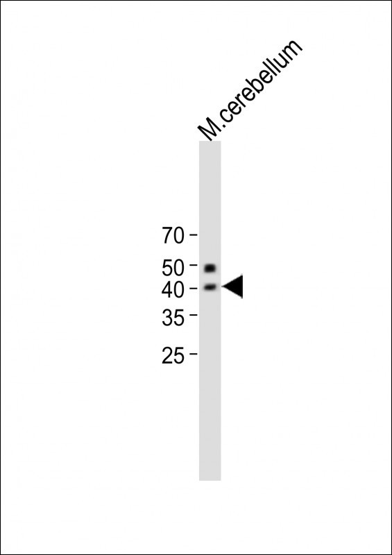 QPCTL Antibody in Western Blot (WB)