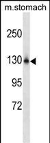 NCKAP1L Antibody in Western Blot (WB)