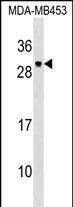 PDF Antibody in Western Blot (WB)