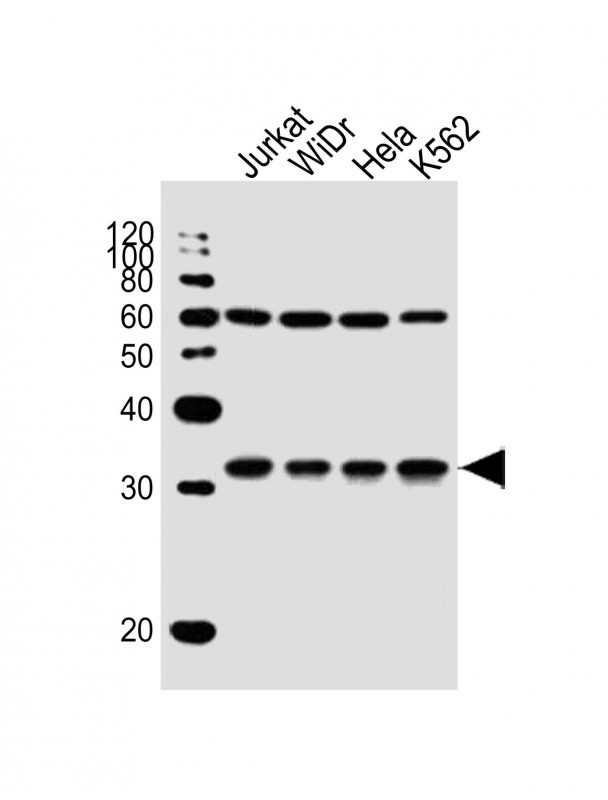 EXOSC6 Antibody in Western Blot (WB)