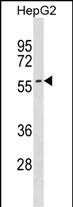 SMPD3 Antibody in Western Blot (WB)