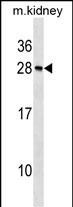 Recoverin Antibody in Western Blot (WB)