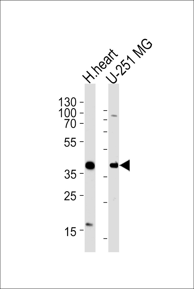 AKTIP Antibody in Western Blot (WB)