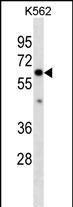 Collagen X Antibody in Western Blot (WB)