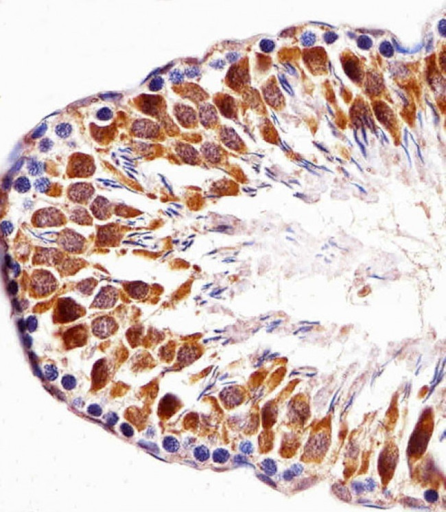 PBK Antibody in Immunohistochemistry (Paraffin) (IHC (P))