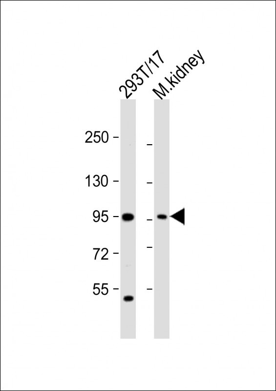 LRRC8A Antibody in Western Blot (WB)