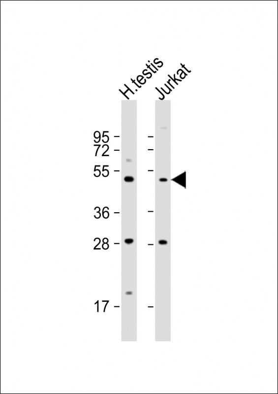 OXCT2 Antibody in Western Blot (WB)