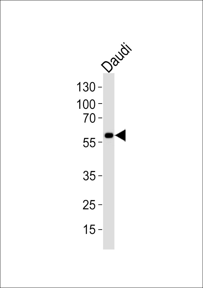 CHRNA9 Antibody in Western Blot (WB)