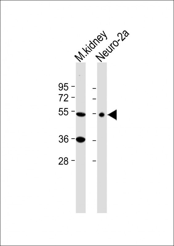 CLN3 Antibody in Western Blot (WB)