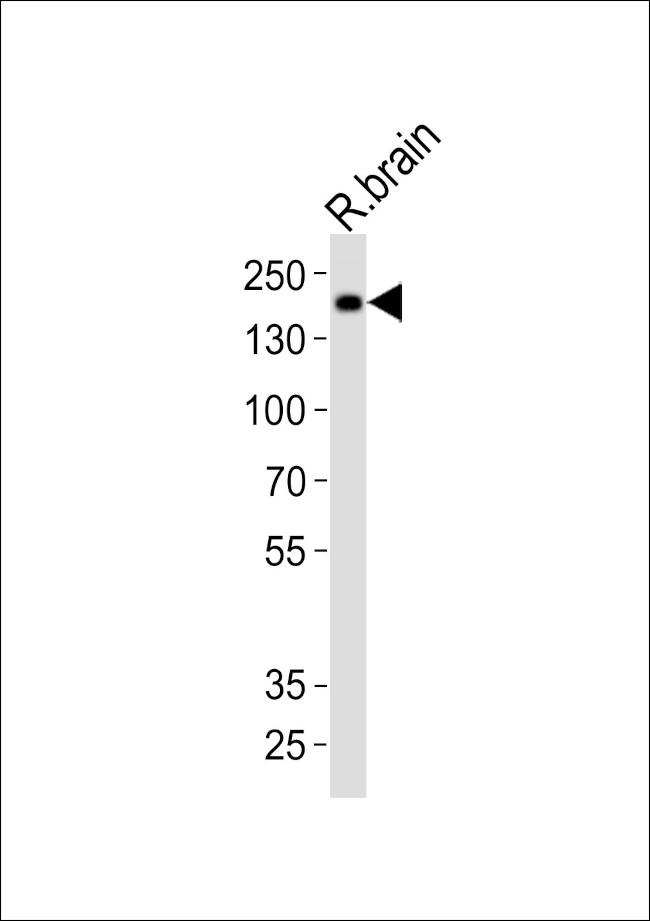 INSRR Antibody in Western Blot (WB)