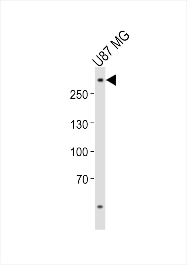 ABCA2 Antibody in Western Blot (WB)