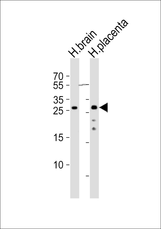 CHMP4A Antibody in Western Blot (WB)