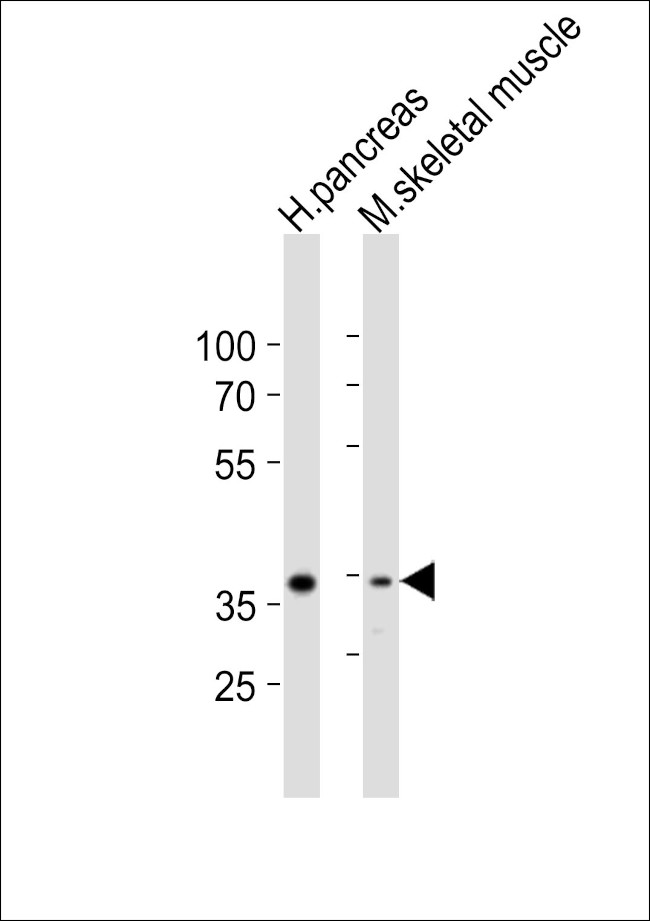 B4GALT7 Antibody in Western Blot (WB)