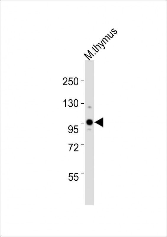 UHRF1 Antibody in Western Blot (WB)