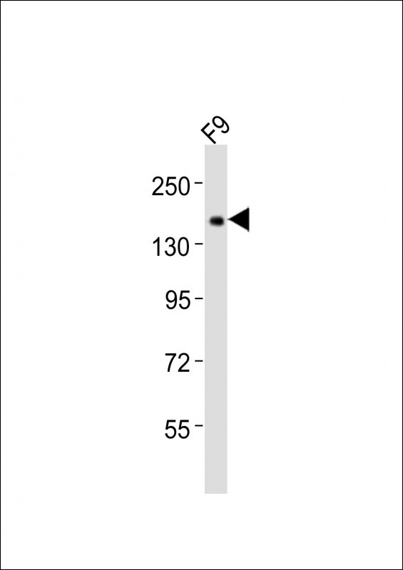 TET1 Antibody in Western Blot (WB)