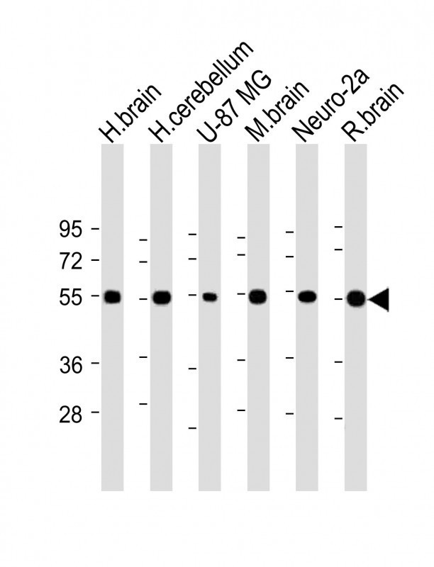 NRXN1 Antibody in Western Blot (WB)