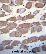 USP29 Antibody in Immunohistochemistry (Paraffin) (IHC (P))