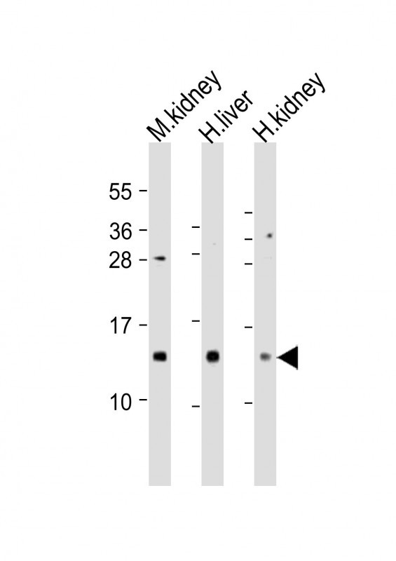 MTCP1 Antibody in Western Blot (WB)