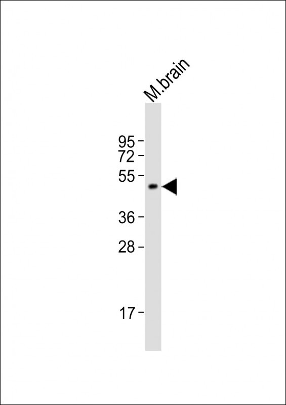 IP6K2 Antibody in Western Blot (WB)