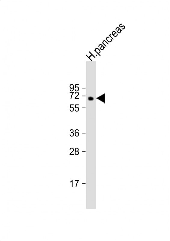 MGAT4B Antibody in Western Blot (WB)