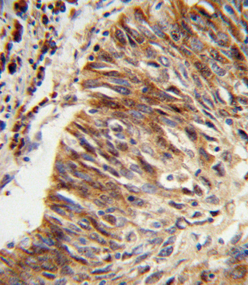 ALDH3B1 Antibody in Immunohistochemistry (Paraffin) (IHC (P))