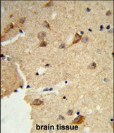 DTX4 Antibody in Immunohistochemistry (Paraffin) (IHC (P))