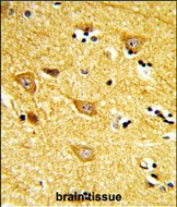 INPP4B Antibody in Immunohistochemistry (Paraffin) (IHC (P))