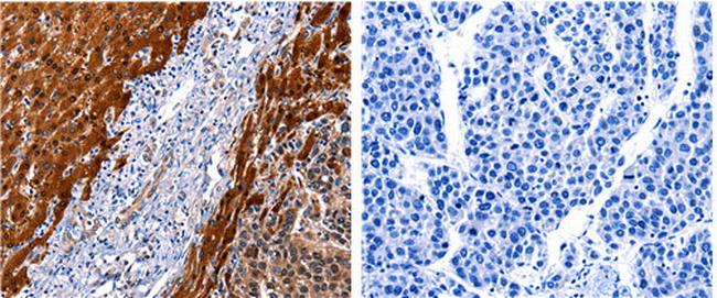 Cullin 4A Antibody in Immunohistochemistry (Paraffin) (IHC (P))