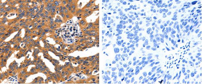 CHRNA3 Antibody in Immunohistochemistry (Paraffin) (IHC (P))