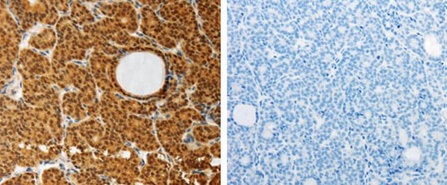 AKR1A1 Antibody in Immunohistochemistry (Paraffin) (IHC (P))