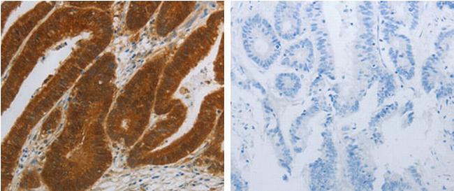 NIT2 Antibody in Immunohistochemistry (Paraffin) (IHC (P))