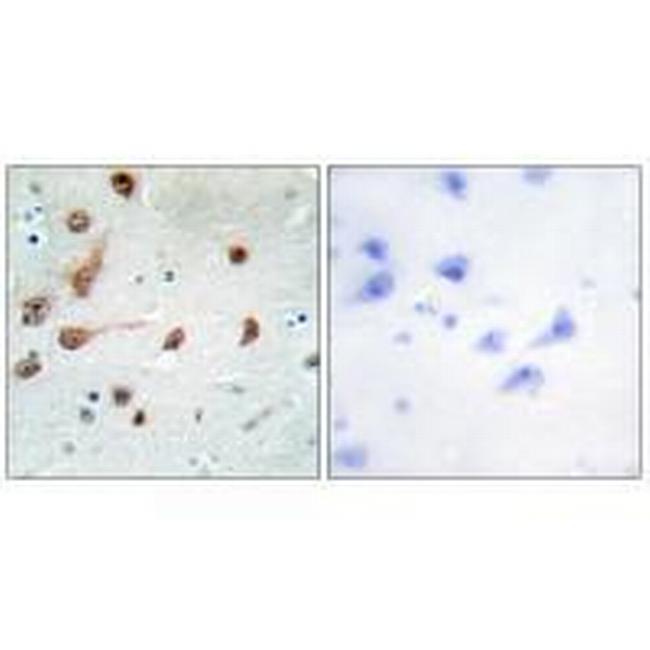 ADAR Antibody in Immunohistochemistry (Paraffin) (IHC (P))