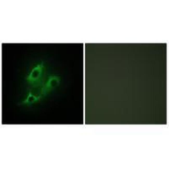 SERC2 Antibody in Immunocytochemistry (ICC/IF)