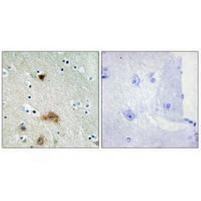 Lass4 Antibody in Immunohistochemistry (Paraffin) (IHC (P))