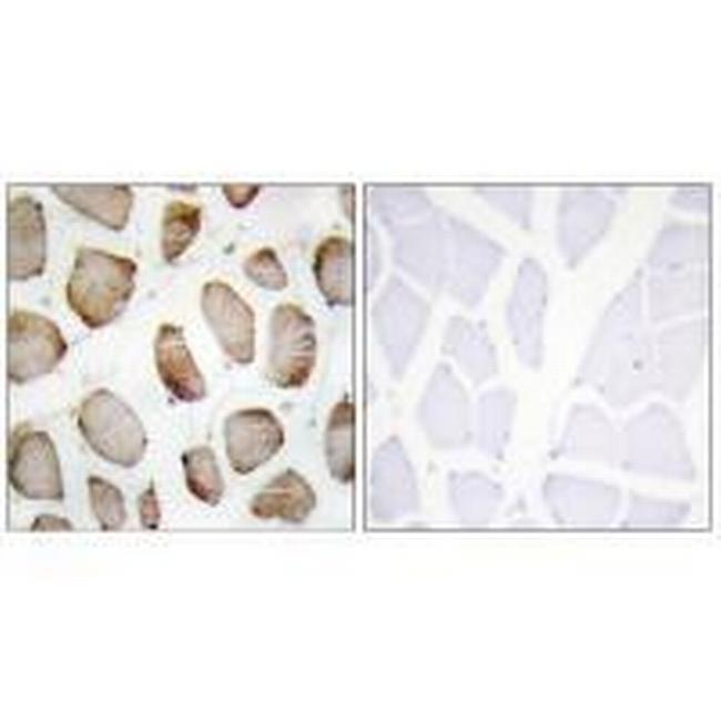 DUS2L Antibody in Immunohistochemistry (Paraffin) (IHC (P))