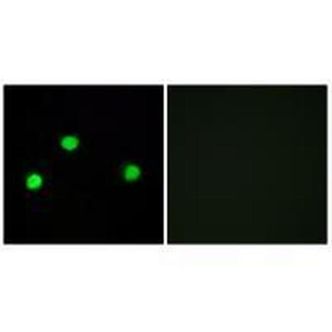 IP6K2 Antibody in Immunocytochemistry (ICC/IF)