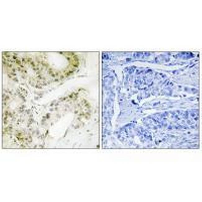 MED13 Antibody in Immunohistochemistry (Paraffin) (IHC (P))