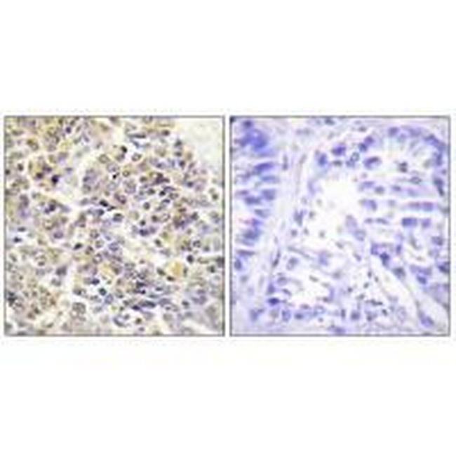 PYCARD Antibody in Immunohistochemistry (Paraffin) (IHC (P))