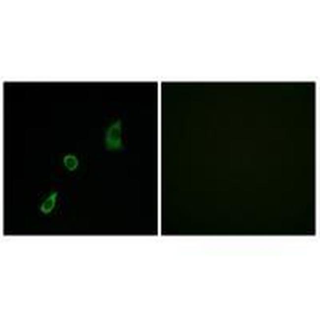 FGF23 Antibody in Immunocytochemistry (ICC/IF)