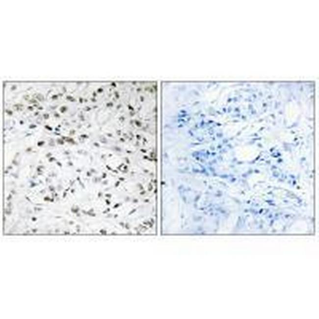 ELOA Antibody in Immunohistochemistry (Paraffin) (IHC (P))