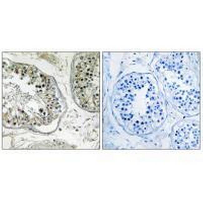 CHST13 Antibody in Immunohistochemistry (Paraffin) (IHC (P))