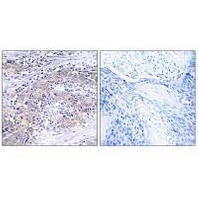 CLN6 Antibody in Immunohistochemistry (Paraffin) (IHC (P))