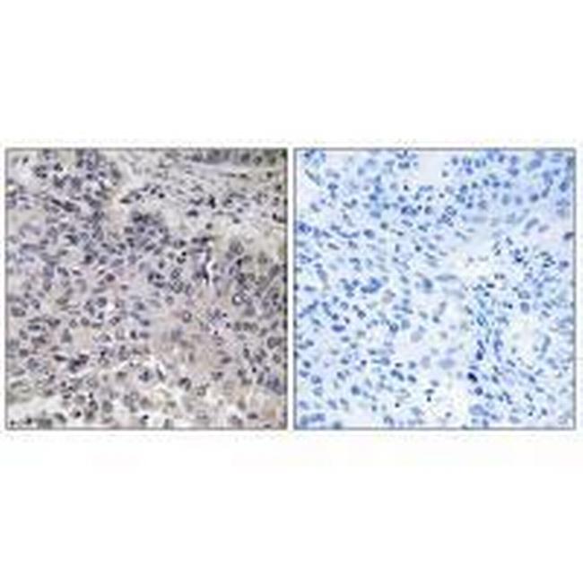 C1QC Antibody in Immunohistochemistry (Paraffin) (IHC (P))