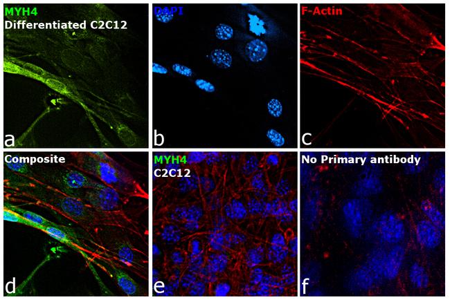 Myosin 4 Antibody in Immunocytochemistry (ICC/IF)