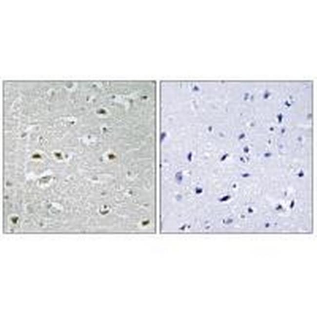 URB1 Antibody in Immunohistochemistry (Paraffin) (IHC (P))