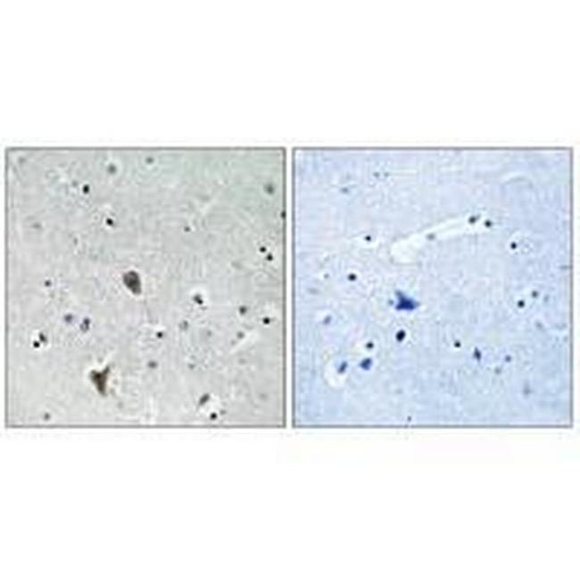 OXR1 Antibody in Immunohistochemistry (Paraffin) (IHC (P))