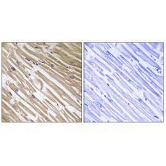 NDRG4 Antibody in Immunohistochemistry (Paraffin) (IHC (P))