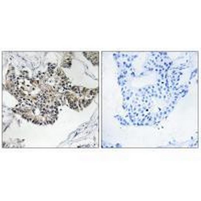 RSAD1 Antibody in Immunohistochemistry (Paraffin) (IHC (P))